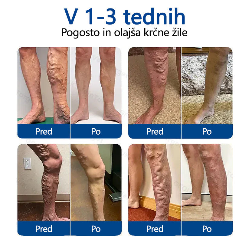 Healrize® VeinTarget mikroiglični obliž🏆