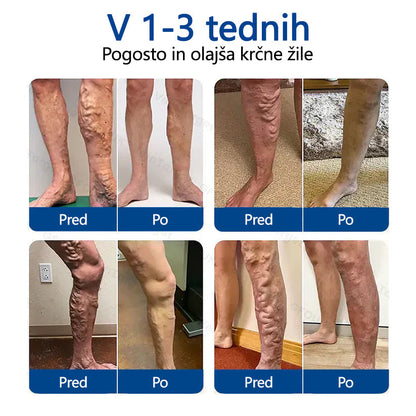 Healrize® VeinTarget mikroiglični obliž🏆