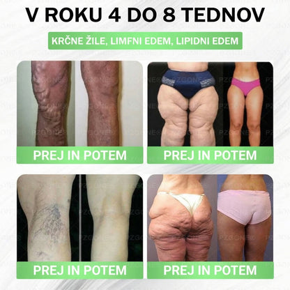 POSEBNA RAZPRODAJA – ZADNJI DAN | 80 % POPUST🌼 ) |𝑳𝒖𝒙𝒂𝒓𝒊𝒔𝒆® 𝑴𝒐𝒓𝒊𝒏𝒈𝒂 𝑿 𝑩𝒆𝒓𝒃𝒆𝒓𝒊𝒏 10-𝑰𝒏-1 𝑵𝒂𝒑𝒓𝒆𝒅𝒆𝒏 𝑵𝒂𝒏𝒐 𝑴𝒊𝒌𝒓𝒐𝒊𝒈𝒍𝒂𝒏𝒋𝒆 𝑵𝒂𝒍𝒆𝒑𝒌𝒂(𝑬𝒏𝒌𝒓𝒂𝒕 𝒅𝒏𝒆𝒗𝒏𝒐, 𝒗𝒊𝒅𝒏𝒆 𝒔𝒑𝒓𝒆𝒎𝒆𝒎𝒃𝒆 𝒗 7 𝒅𝒏𝒆𝒉） 𝑫𝒆𝒃𝒆𝒍𝒐𝒔𝒕, 𝒔𝒍𝒂𝒅𝒌𝒐𝒓𝒏𝒂 𝒃𝒐𝒍𝒆𝒛𝒆𝒏, 𝒂𝒑𝒏𝒆𝒋𝒂 𝒎𝒆𝒅 𝒔𝒑𝒂𝒏𝒋𝒆𝒎 𝒊𝒏 𝒕𝒆ž𝒂𝒗𝒆 𝒔 𝒔𝒌𝒍𝒆𝒑𝒊👩‍🔬