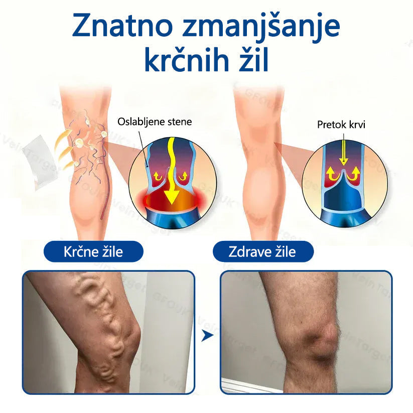 Healrize® VeinTarget mikroiglični obliž🏆