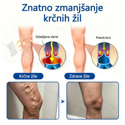 Healrize® VeinTarget mikroiglični obliž🏆